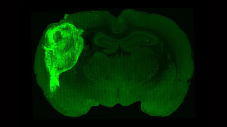 Implanted Human Brain Cells Rats Nature 3