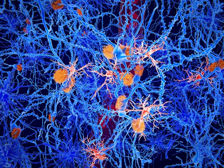 Cells Alzheimer Neurons Brain Nature 4