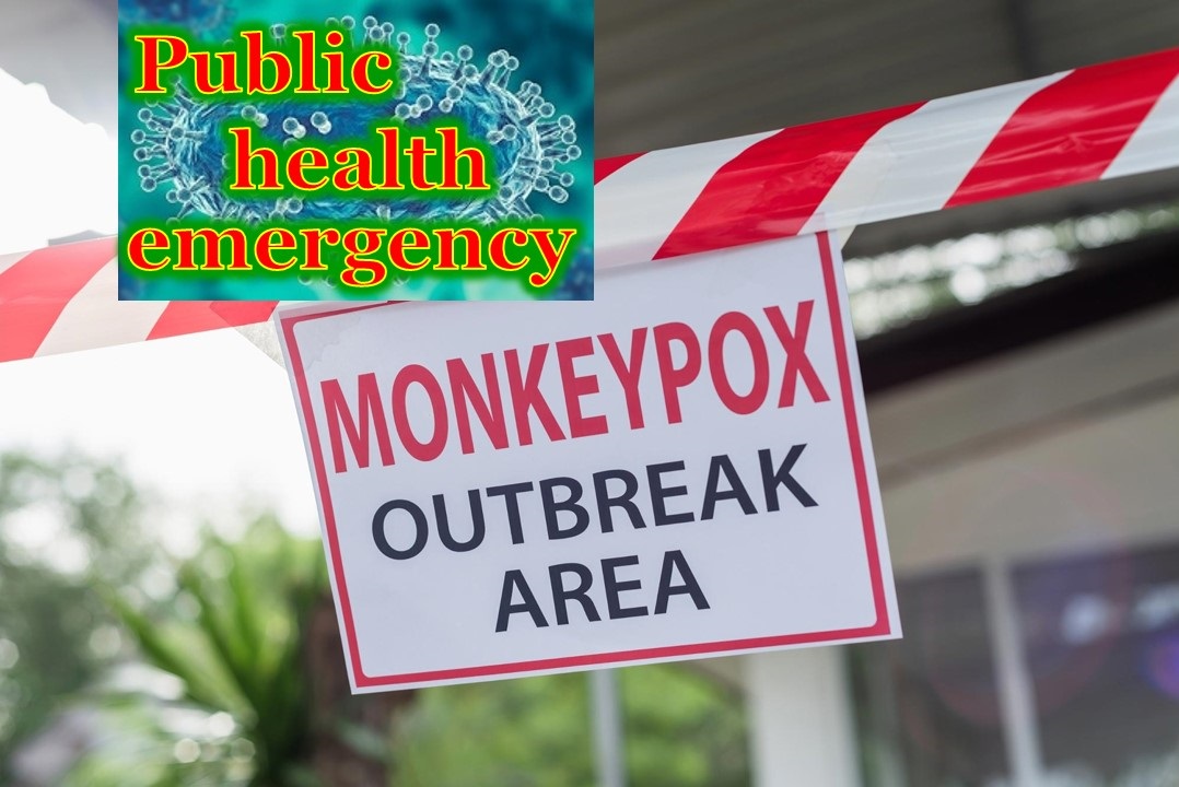 Monkeypox is emergency of international concern: WHO