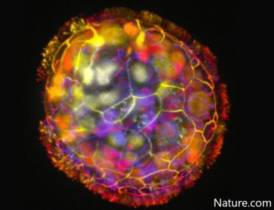 ‘Anthrobots’, human-cell robots might help us heal
