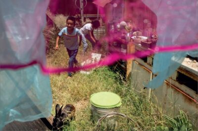 Living with cleft lip and palate in Oaxaca